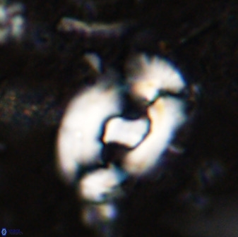 Helicosphaera seminulum 49135