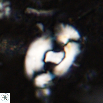 Helicosphaera seminulum 49135