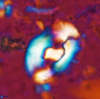 Helicosphaera seminulum 49136