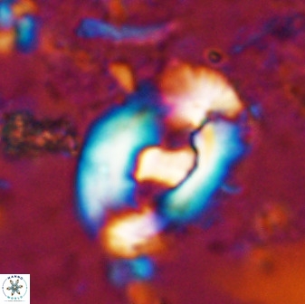 Helicosphaera seminulum 49136