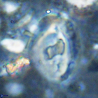Helicosphaera seminulum 49139