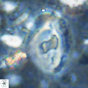 Helicosphaera seminulum 49139