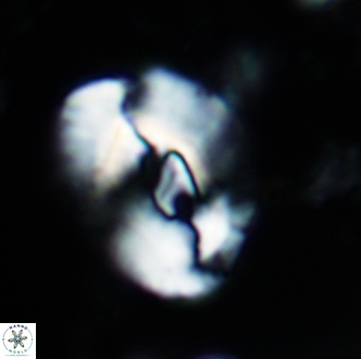 Helicosphaera seminulum 1989