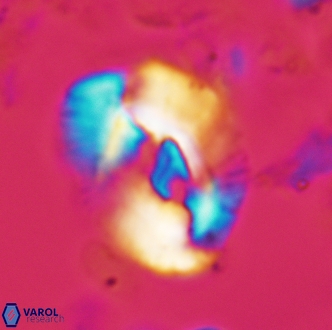 Helicosphaera seminulum 1990