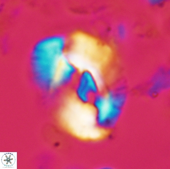 Helicosphaera seminulum 1990