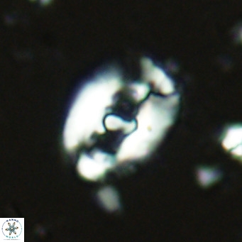 Helicosphaera seminulum VR 02722