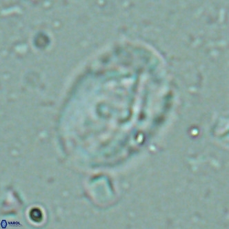 Helicosphaera seminulum VR 02723