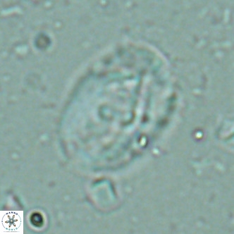 Helicosphaera seminulum VR 02723