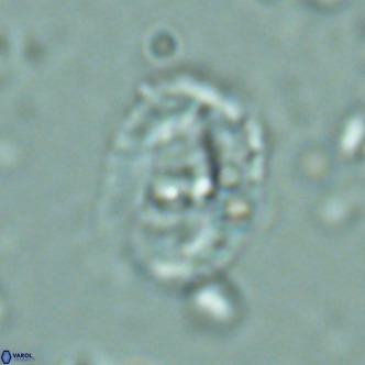 Helicosphaera seminulum VR 02724