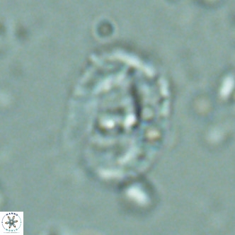 Helicosphaera seminulum VR 02724