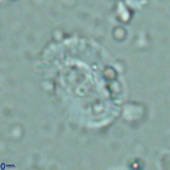 Helicosphaera seminulum VR 02726