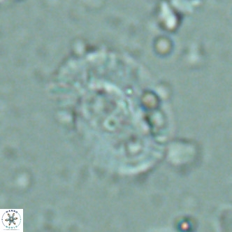 Helicosphaera seminulum VR 02726