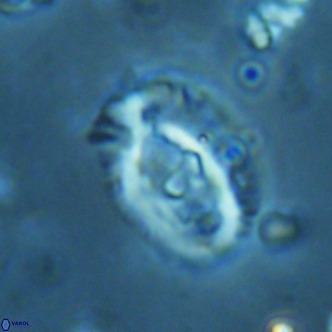 Helicosphaera seminulum VR 02727