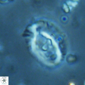 Helicosphaera seminulum VR 02727