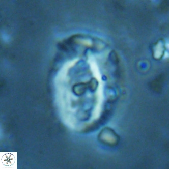 Helicosphaera seminulum VR 02728