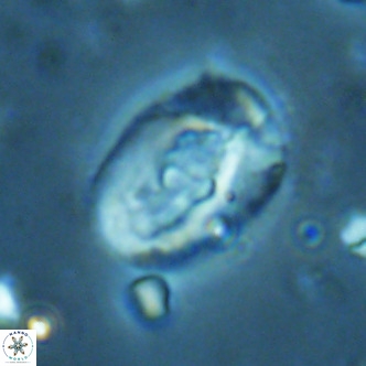Helicosphaera seminulum VR 02729