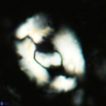 Helicosphaera seminulum VR 03072