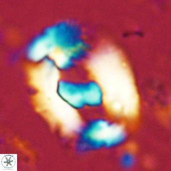 Helicosphaera seminulum VR 03073
