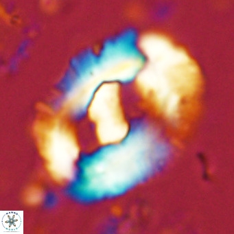 Helicosphaera seminulum VR 03074