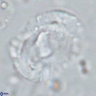 Helicosphaera seminulum VR 03076