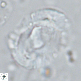 Helicosphaera seminulum VR 03076