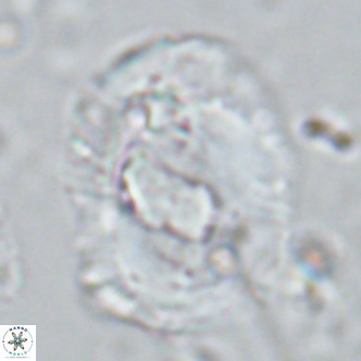 Helicosphaera seminulum VR 03077