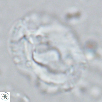 Helicosphaera seminulum VR 03078