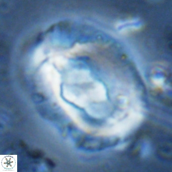 Helicosphaera seminulum VR 03079