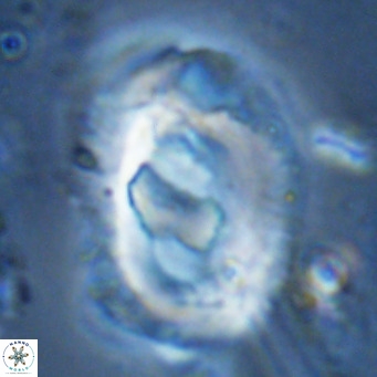 Helicosphaera seminulum VR 03080