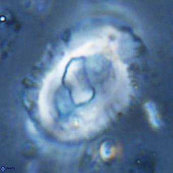 Helicosphaera seminulum VR 03081