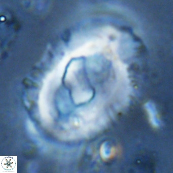 Helicosphaera seminulum VR 03081