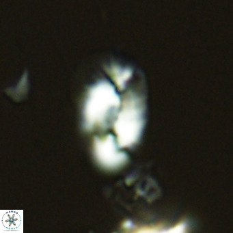 Helicosphaera tenebricornus VR 05803