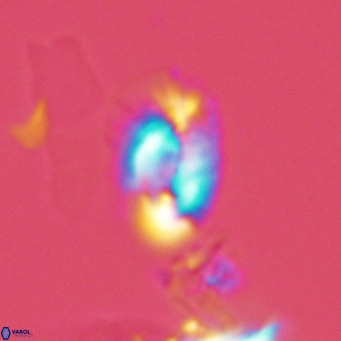 Helicosphaera tenebricornus VR 05804