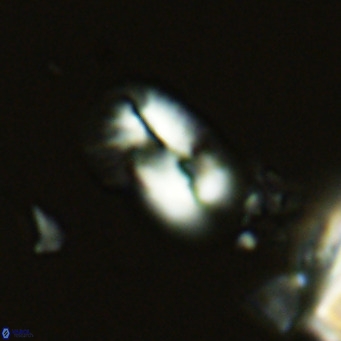 Helicosphaera tenebricornus VR 05806