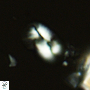 Helicosphaera tenebricornus VR 05806