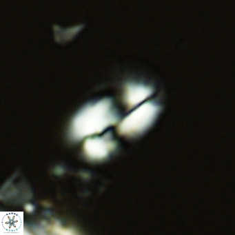 Helicosphaera tenebricornus VR 05809