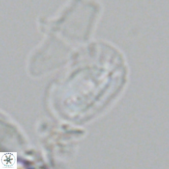 Helicosphaera tenebricornus VR 05810
