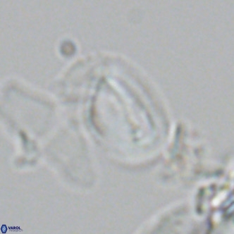 Helicosphaera tenebricornus VR 05812