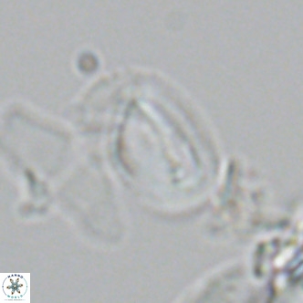 Helicosphaera tenebricornus VR 05812