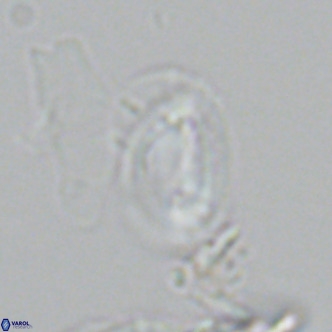 Helicosphaera tenebricornus VR 05814