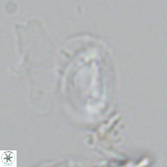 Helicosphaera tenebricornus VR 05814