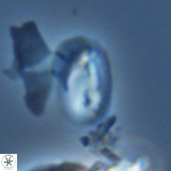 Helicosphaera tenebricornus VR 05815