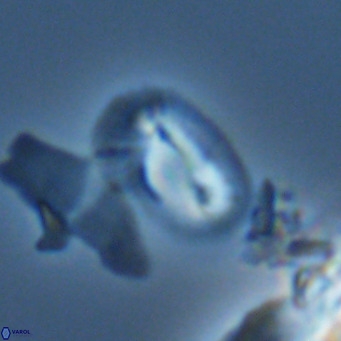 Helicosphaera tenebricornus VR 05816