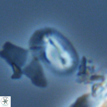 Helicosphaera tenebricornus VR 05816