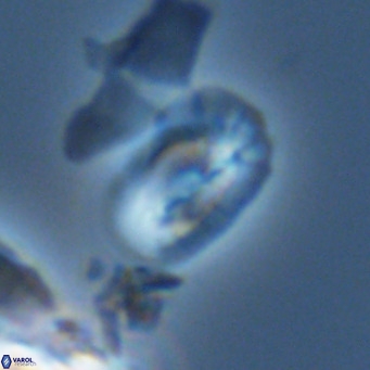 Helicosphaera tenebricornus VR 05817