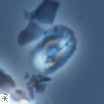 Helicosphaera tenebricornus VR 05817