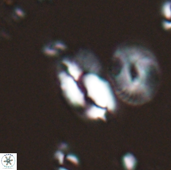 Helicosphaera tenebriscornus 27607