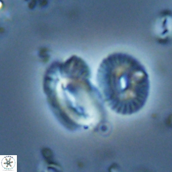 Helicosphaera tenebriscornus 27614