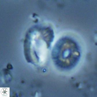 Helicosphaera tenebriscornus 27615