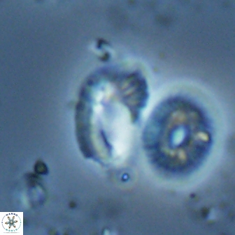 Helicosphaera tenebriscornus 27616